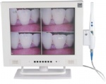 Intraoral camera