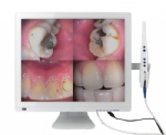 Intraoral camera-19inch monitor
